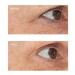 Perricone MD Essential Fx Acyl-Glutathione Eyelid Lift Serum liftingové oční sérum 15 ml