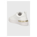 Sneakers boty Liu Jo SILVIA 86 bílá barva, BF3005EX01401111