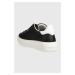 Kožené sneakers boty Love Moschino černá barva, JA15374G1HIA100A