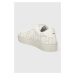 Sneakers boty Furla Joy bílá barva, YH57FJO BX2763 2874S