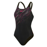 Speedo hyperboom placement muscleback black/electric pink/usa charcoal