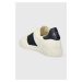 Sneakers boty Armani Exchange bílá barva, XUX173 XV666 N481