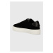 Semišové sneakers boty Furla JOY černá barva, YH80FJO BX2909 O6000