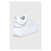 Boty Karl Lagerfeld Anakapri bílá barva, na platformě