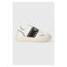 Sneakers boty Love Moschino bílá barva, JA15284G1IJC510A