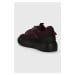 Sneakers boty GARMENT PROJECT Alaska Low černá barva, GPWF2495