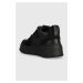 Kožené sneakers boty Chiara Ferragni černá barva, CF3218_001