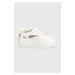 Sneakers boty Twinset bílá barva, 231ACP112