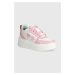 Kožené sneakers boty Chiara Ferragni Sneakers School růžová barva, CF3217_012