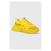 Sneakers boty Patrizia Pepe žlutá barva, 8Z0043 V005 Y447