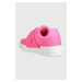 Kožené sneakers boty Chiara Ferragni CF3109_037 růžová barva, CF1 LOW